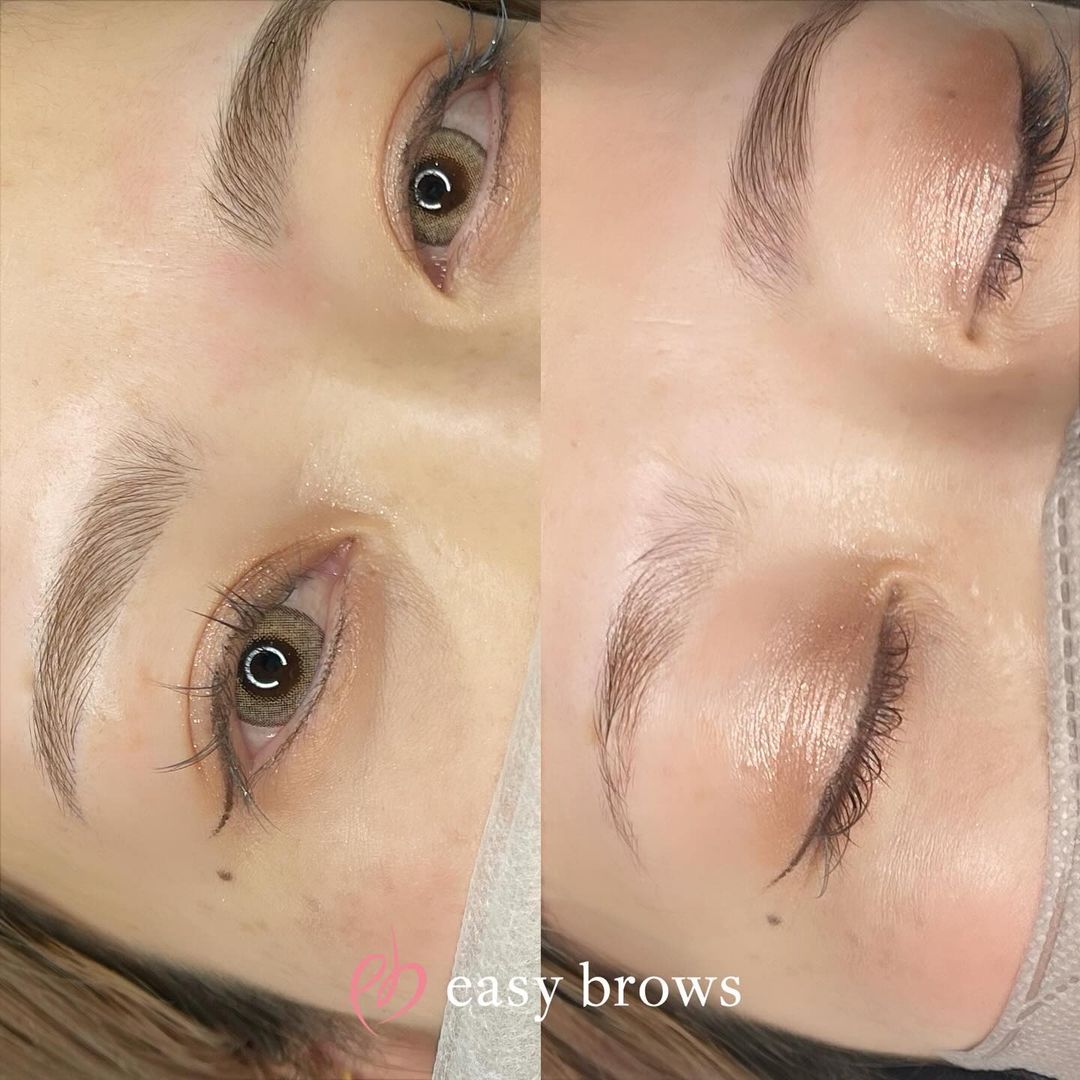 眉アートメイク 症例写真1