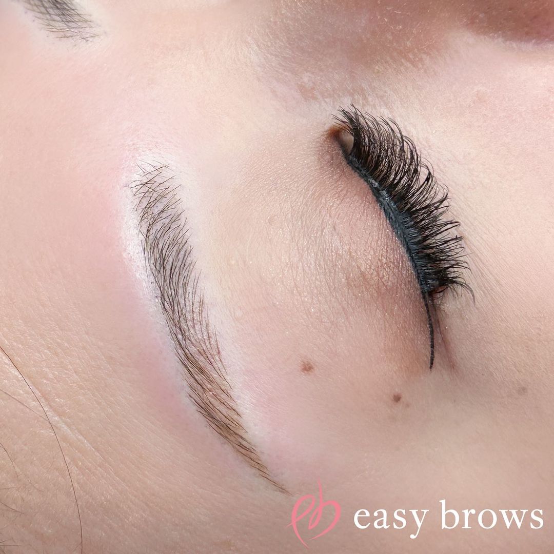 眉アートメイク 症例写真2