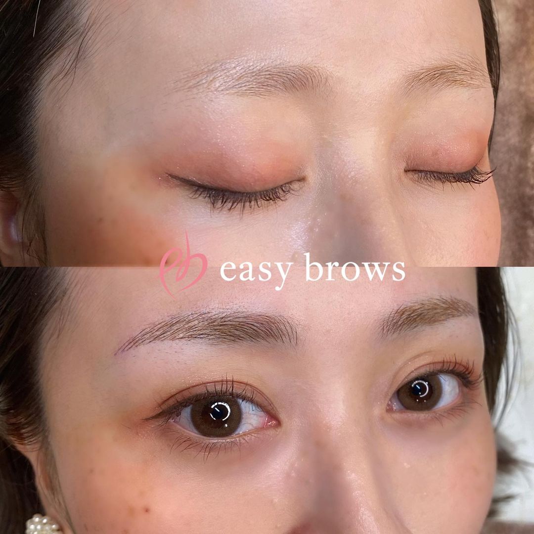 眉アートメイク 症例写真4