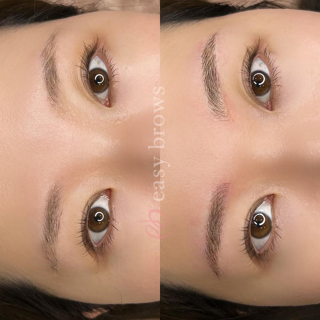 眉アートメイク 症例写真5