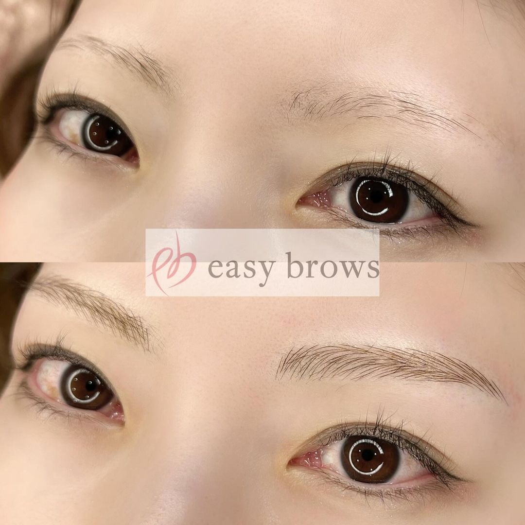 眉アートメイク 症例写真6