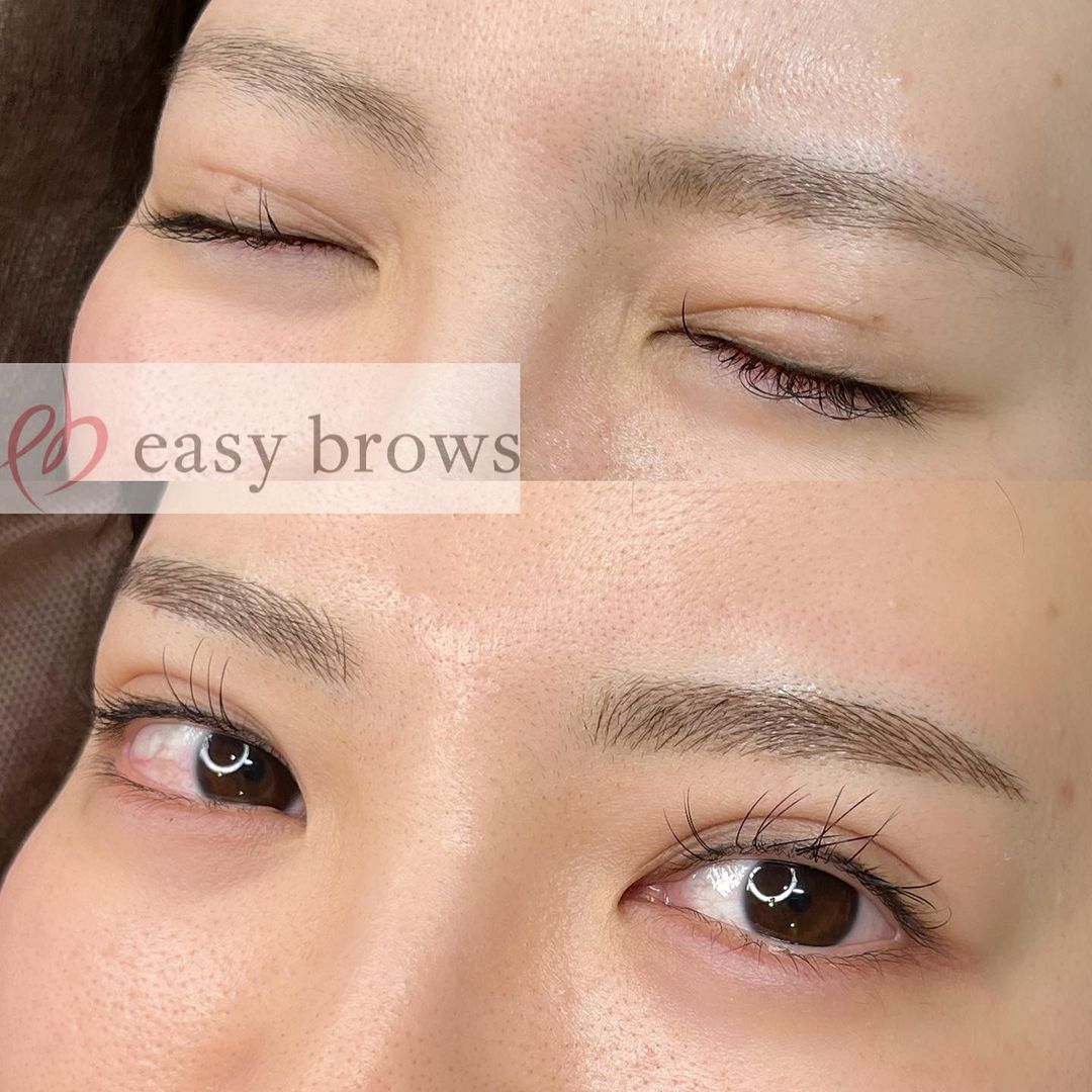 眉アートメイク 症例写真8