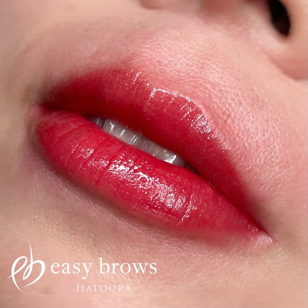 リップ 症例写真4