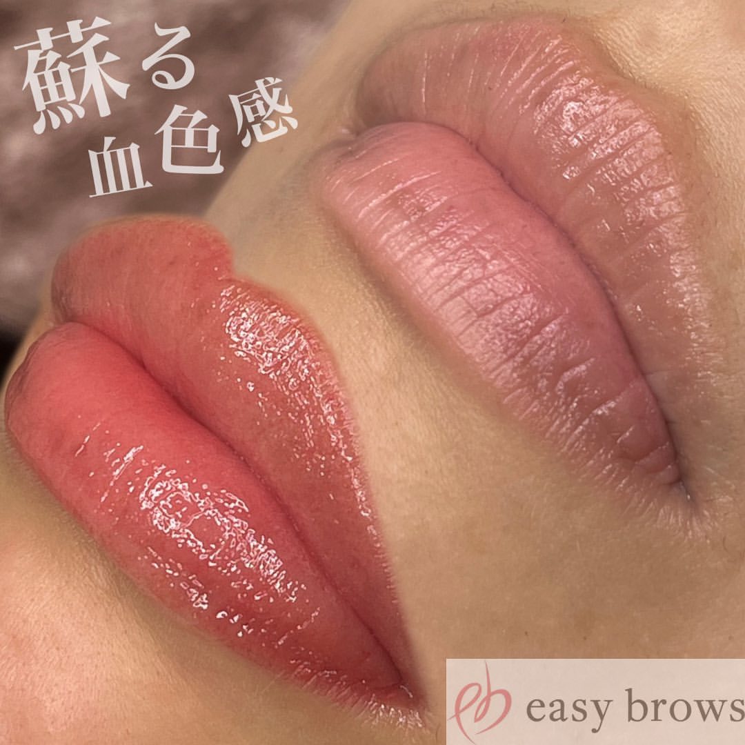 リップ 症例写真8